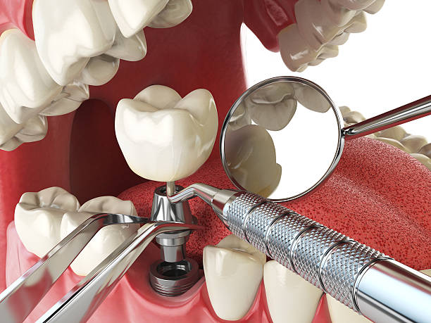 Best Urgent Tooth Repair  in Columbus, MN